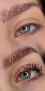 eye comparison